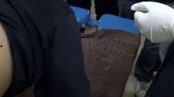 针灸疗法视频,传统中医的神奇疗效揭秘